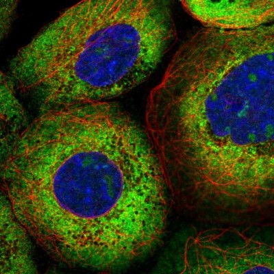 Immunocytochemistry/Immunofluorescence: LARP5 Antibody [NBP2-55184] - Staining of human cell line A-431 shows localization to nucleoli & cytosol.