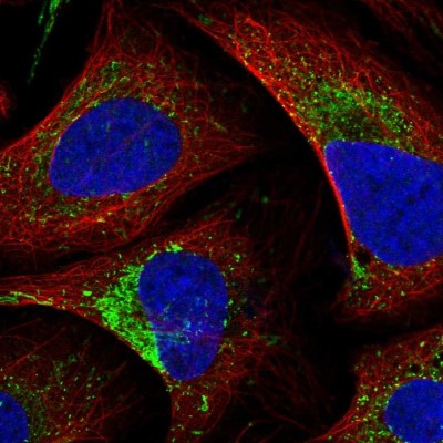 Immunocytochemistry/Immunofluorescence: AMBRA1 Antibody [NBP2-32640] - Immunofluorescent staining of human cell line U-2 OS shows localization to mitochondria & vesicles.
