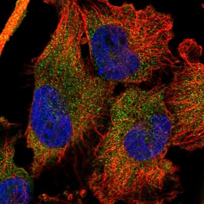 Immunocytochemistry/Immunofluorescence: DDX60 Antibody [NBP1-91826] - Immunofluorescent staining of human cell line U-251 MG shows localization to cytosol.