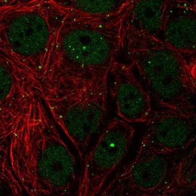 Immunocytochemistry/Immunofluorescence: TH1L Antibody [NBP2-55400] - Staining of human cell line MCF7 shows localization to nucleoplasm, nuclear bodies & vesicles.