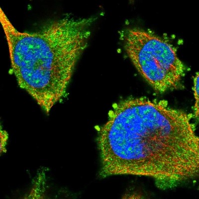 Immunocytochemistry/Immunofluorescence: LRRC16A Antibody [NBP1-91221] - Immunofluorescent staining of human cell line U-251 MG shows localization to nuclear speckles & cytosol.