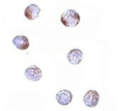 Immunocytochemistry/Immunofluorescence: KLHL15 Antibody [NBP1-77359] - HeLa cells with KLHL15 antibody at 5 ug/ml.