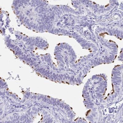 Immunohistochemistry-Paraffin: C4orf17 Antibody [NBP2-31831] - Staining of human fallopian tube shows strong membranous positivity in glandular cells.