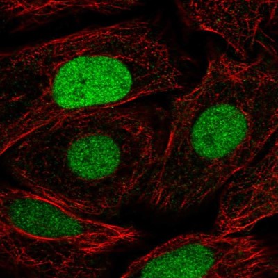 Immunocytochemistry/Immunofluorescence: NFAT5 Antibody [NBP2-49612] - Immunofluorescent staining of human cell line SiHa shows localization to nucleus.