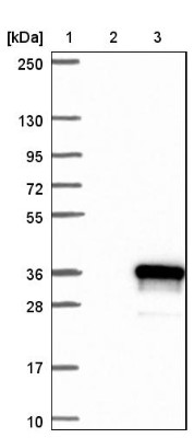 Western Blot: C17orf82 Antibody [NBP1-91718] - Lane 1: Marker [kDa] 250, 130, 95, 72, 55, 36, 28, 17, 10. Lane 2: Negative control (vector only transfected HEK293T lysate). Lane 3: Over-expression lysate (Co-expressed with a C-terminal myc-DDK tag (3.1 kDa) in mammalian HEK293T cells).