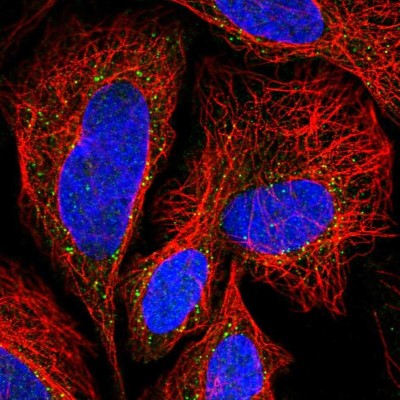 Immunocytochemistry/Immunofluorescence: TLCD2 Antibody [NBP2-14562] - Immunofluorescent staining of human cell line SiHa shows localization to vesicles.