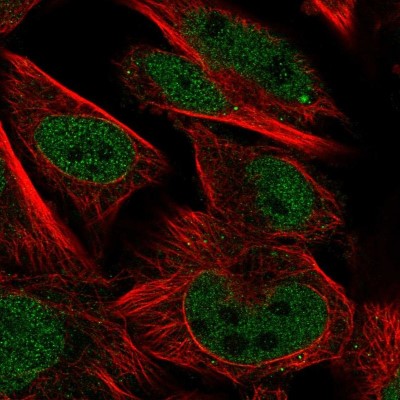 Immunocytochemistry/Immunofluorescence: AKIRIN1 Antibody [NBP2-14749] - Immunofluorescent staining of human cell line U-251 MG shows localization to nucleoplasm.