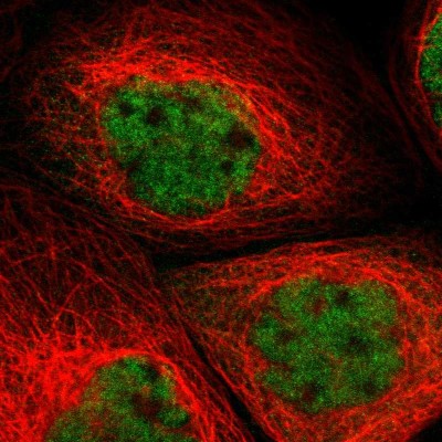 Immunocytochemistry/Immunofluorescence: GRRP1 Antibody [NBP1-94054] - Staining of human cell line A-431 shows positivity in nuclei but not nucleoli.