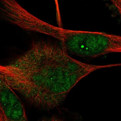 Immunocytochemistry/Immunofluorescence: DRGX Antibody [NBP1-94059] - Staining of human cell line U-251 MG shows positivity in nucleoli and nucleus but not nucleoli.