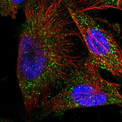 Immunocytochemistry/Immunofluorescence: Methyltransferase like 6 Antibody [NBP1-92108] - Immunofluorescent staining of human cell line U-251 MG shows localization to vesicles.