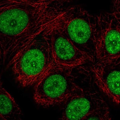 Immunocytochemistry/Immunofluorescence: CD2BP2 Antibody [NBP2-49328] - Analysis of human cell line MCF7 shows positivity in nucleus & nucleoli.