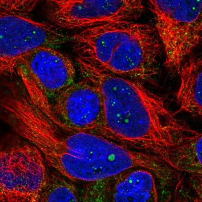 Immunocytochemistry/Immunofluorescence: PXMP4 Antibody [NBP2-14703] - Staining of human cell line CACO-2 shows localization to nucleoli fibrillar center & peroxisomes.