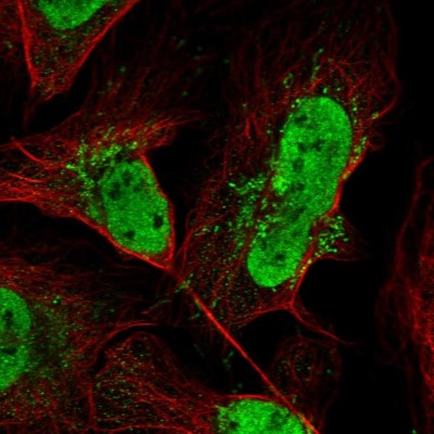Immunocytochemistry/Immunofluorescence: FAM170b Antibody [NBP2-13985] - Staining of human cell line U-2 OS shows positivity in nucleus but not nucleoli and mitochondria.