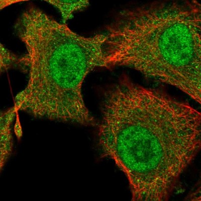 Immunocytochemistry/Immunofluorescence: tescalcin Antibody [NBP2-13426] - Immunofluorescent staining of human cell line A549 shows localization to nucleoplasm & cytosol.