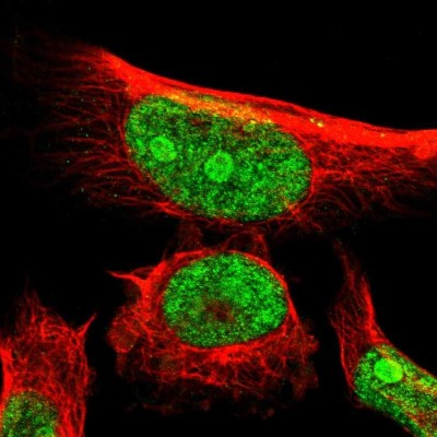 Immunocytochemistry/Immunofluorescence: ERMP1 Antibody [NBP2-13970] - Immunofluorescent staining of human cell line U-251 MG shows localization to nucleus & nucleoli.