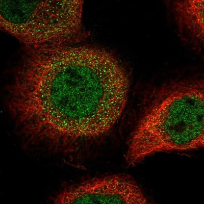 Immunocytochemistry/Immunofluorescence: LRRC42 Antibody [NBP2-30483] - Immunofluorescent staining of human cell line A-431 shows localization to nucleoplasm & cytosol.