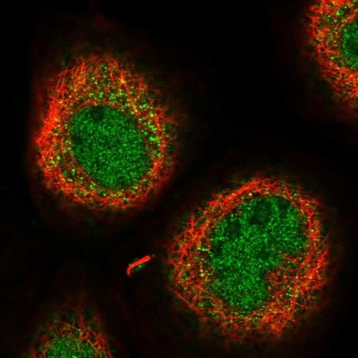Immunocytochemistry/Immunofluorescence: GEM Interacting Protein Antibody [NBP2-30537] - Staining of human cell line A-431 shows localization to nucleoplasm & cytosol.