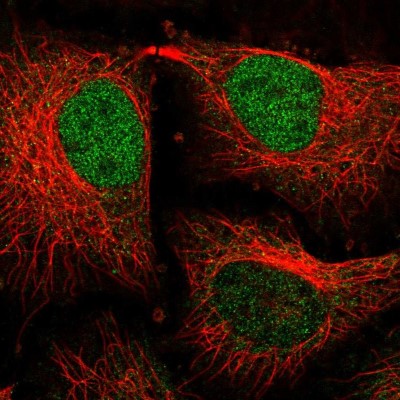 Immunocytochemistry/Immunofluorescence: TM2D3 Antibody [NBP2-30535] - Immunofluorescent staining of human cell line HeLa shows localization to nucleoplasm & cytosol.