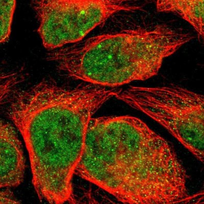Immunocytochemistry/Immunofluorescence: Myotubularin Related Protein 10 Antibody [NBP2-30553] - Staining of human cell line U-2 OS shows localization to nucleoplasm, nuclear bodies & cytosol.