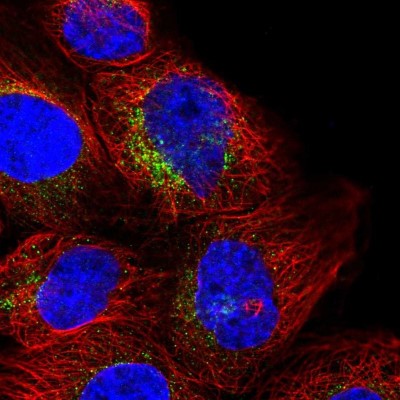 Immunocytochemistry/Immunofluorescence: RNF144A Antibody [NBP2-13238] - Immunofluorescent staining of human cell line A-431 shows localization to vesicles.