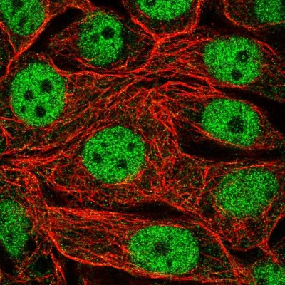 Immunocytochemistry/Immunofluorescence: RFXANK Antibody [NBP2-13225] - Immunofluorescent staining of human cell line MCF7 shows localization to nucleoplasm.