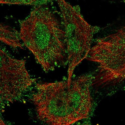 Immunocytochemistry/Immunofluorescence: SIN3B Antibody [NBP2-13309] - Immunofluorescent staining of human cell line U-251 MG shows localization to nucleoplasm & plasma membrane.