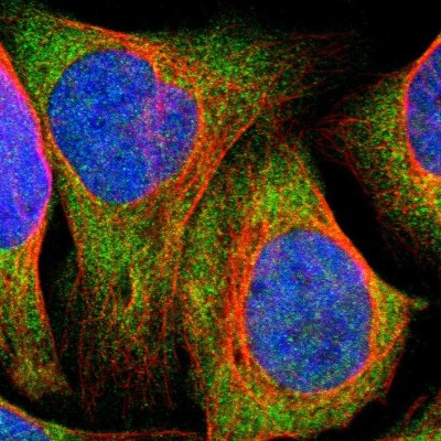 Immunocytochemistry/Immunofluorescence: SDK1 Antibody [NBP1-93882] - Immunofluorescent staining of human cell line U-2 OS shows localization to cytosol.