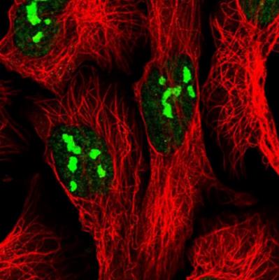 Immunocytochemistry/Immunofluorescence: FTSJ3 Antibody [NBP2-30672] - Staining  of human cell line U-2 OS shows positivity in nucleus and nucleoli. Antibody staining is shown in green.