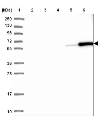 Western Blot: Coronin-1a Antibody [NBP2-13861] - Lane 1: Marker  [kDa] 250, 130, 95, 72, 55, 36, 28, 17, 10.  Lane 2: Human cell line RT-4.  Lane 3: Human cell line U-251MG sp.  Lane 4: Human plasma (IgG/HSA depleted).  Lane 5: Human liver tissue.  Lane 6: Human tonsil tissue