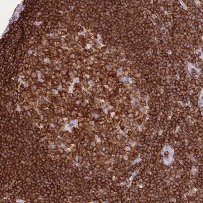 Immunohistochemistry-Paraffin: Coronin-1a Antibody [NBP2-13861] - Staining of human tonsil shows cytoplasmic positivity in germinal center cells and non-germinal center cells.