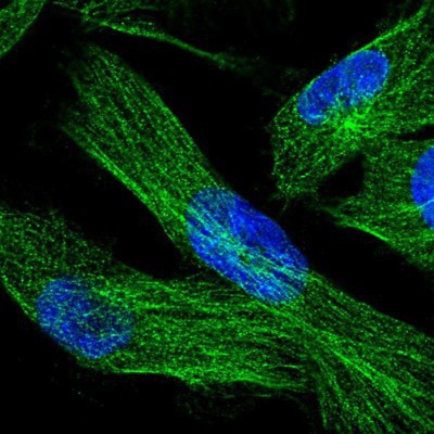 Immunocytochemistry/Immunofluorescence: DOC2B Antibody [NBP2-13930] Staining of human cell line U-251 MG shows positivity in cytoskeleton (microtubules).