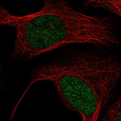 Immunocytochemistry/Immunofluorescence: MBD6 Antibody [NBP2-38435] - Immunofluorescent staining of human cell line U-2 OS shows localization to nucleus.