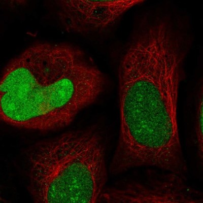 Immunocytochemistry/Immunofluorescence: IZUMO2 Antibody [NBP1-90720] - Staining of human cell line U-2 OS shows positivity in nucleus and nucleoli.