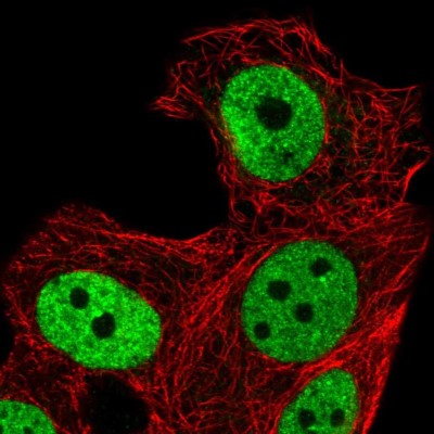 Immunocytochemistry/Immunofluorescence: ZNF41 Antibody [NBP2-49585] - Immunofluorescent staining of human cell line MCF7 shows localization to nucleoplasm.