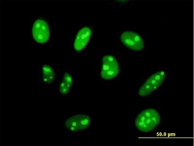 Immunocytochemistry/Immunofluorescence: DIMT1L Antibody [H00027292-B01P] - Analysis of purified antibody to DIMT1L on HeLa cell. (antibody concentration 10 ug/ml)