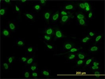 Immunocytochemistry/Immunofluorescence: TAF11 Antibody (2G9) [H00006882-M04] - Analysis of monoclonal antibody to TAF11 on HeLa cell. Antibody concentration 10 ug/ml