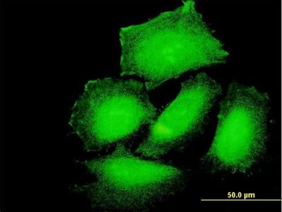 Immunocytochemistry/Immunofluorescence: PPP1R3B Antibody [H00079660-B01P] - Analysis of purified antibody to PPP1R3B on HeLa cell. (antibody concentration 10 ug/ml)