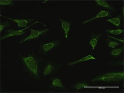 Immunocytochemistry/Immunofluorescence: IMPA1 Antibody [H00003612-D01P] - Analysis of antibody to IMPA1 on HeLa cell. Antibody concentration 10 ug/ml.