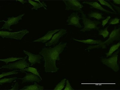 Immunocytochemistry/Immunofluorescence: nef-associated protein 1 Antibody [H00051531-B01P] - Analysis of purified antibody to C9orf156 on HeLa cell. (antibody concentration 10 ug/ml)