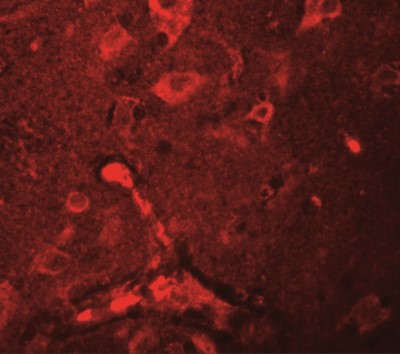 Immunocytochemistry/Immunofluorescence: APBA2 Antibody [NBP2-41127] - Immunofluorescence of APBA2 in human brain tissue with APBA2 antibody at 20 ug/mL.
