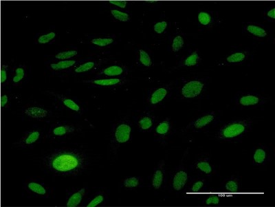 Immunocytochemistry/Immunofluorescence: CMAS Antibody (2E1) [H00055907-M05] - Analysis of monoclonal antibody to CMAS on HeLa cell. Antibody concentration 10 ug/ml