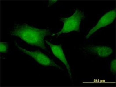 Immunocytochemistry/Immunofluorescence: RGS20 Antibody (3E10) [H00008601-M04] - Analysis of monoclonal antibody to RGS20 on HeLa cell. Antibody concentration 10 ug/ml