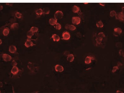 Immunocytochemistry/Immunofluorescence: FAM82A Antibody [NBP2-41121] - Immunofluorescence of FAM82A1 in K562 cells with FAM82A1 antibody at 20 ug/mL.