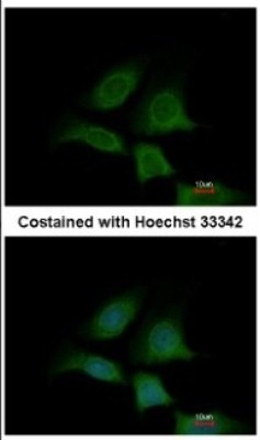Immunocytochemistry/Immunofluorescence: Sec8 Antibody [NBP2-20283] - Immunofluorescence analysis of methanol-fixed MCF-7, using antibody at 1:200 dilution.