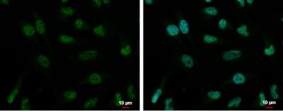 Immunocytochemistry/Immunofluorescence: ZNF189 Antibody [NBP2-20971] - HeLa cells were fixed in 4% paraformaldehyde at RT for 15 min. Green: ZNF189 protein stained by ZNF189 antibody  diluted at 1:2000. Blue: Hoechst 33342 staining.