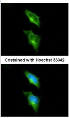 Immunocytochemistry/Immunofluorescence: GPR82 Antibody [NBP2-16725] - Immunofluorescence analysis of methanol-fixed HeLa, using antibody at 1:200 dilution.