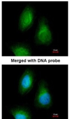 Immunocytochemistry/Immunofluorescence: SEPHS2 Antibody [NBP1-32645] - Paraformaldehyde-fixed HeLa, using antibody at 1:200 dilution.