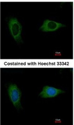 Immunocytochemistry/Immunofluorescence: EVC2 Antibody [NBP1-31268] - Analysis of methanol-fixed HeLa, using antibody at 1:500 dilution.