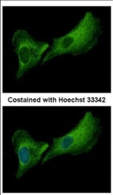 Immunocytochemistry/Immunofluorescence: DNASE2B Antibody [NBP2-16199] - Immunofluorescence analysis of methanol-fixed A549, using antibody at 1:500 dilution.