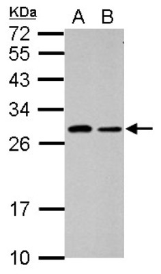 Western Blot: C1orf111 Antibody [NBP2-15640] - Sample (30 ug of whole cell lysate) A: PC-3 B: SK-N-SH 12% SDS PAGE gel, diluted at 1:1000.